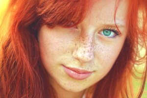 How to get rid of freckles