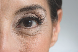 How to remove facial wrinkles around the eyes