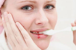 How to get rid of bleeding gums