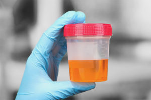 Blood in a dog’s urine